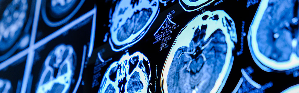 Close-up of CT scan with brain. Medicine, science and education MRI brain background. Magnetic resonance imaging. Tomography shot.